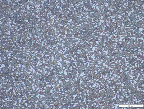 Microscope image of K390 carbide structure used for comparison with MagnaMax, illustrating similar carbide volume and slightly larger carbide distribution.